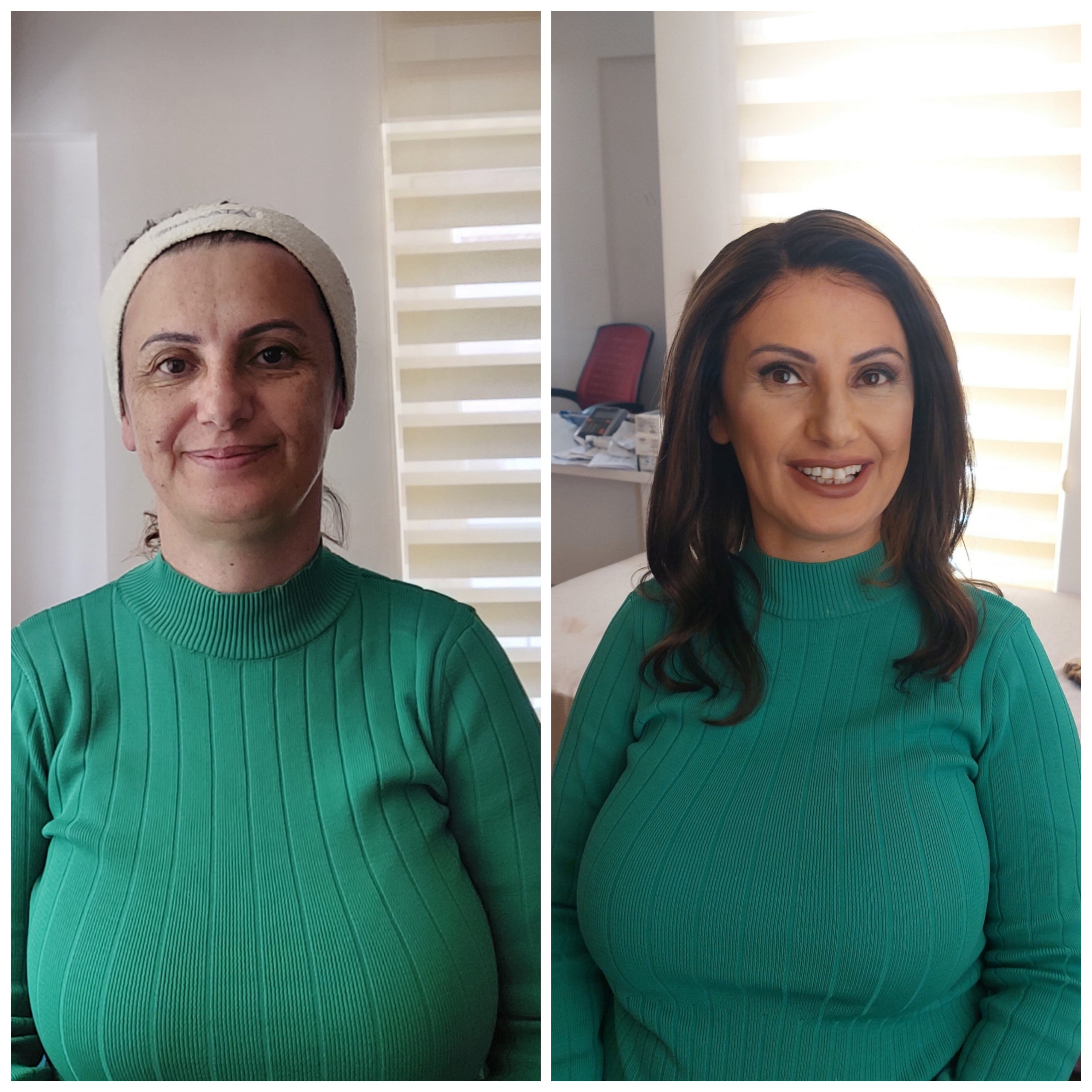 HAYLEY KOYU KAHVE IŞILTILI DANTEL PERUK ÜNİTESİ